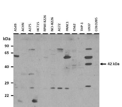 Western Blot: NEU2 Antibody [NBP3-10993]